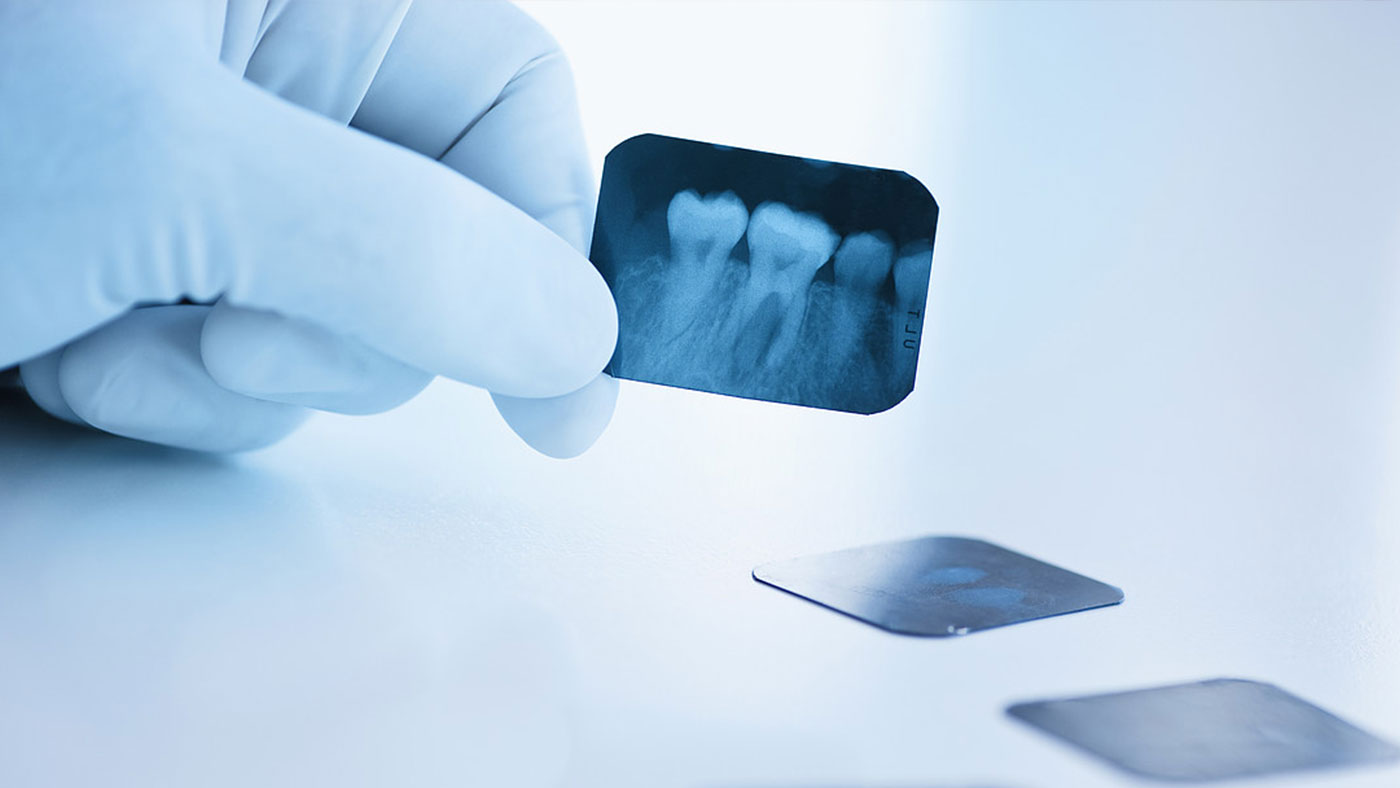 Radiografia Endodoncia El Salvador